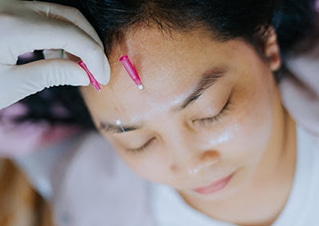 Treo Cung Chân Mày Giấu Chỉ 6 Tiến hành nâng cung mày giấu chỉ