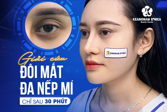 WEb mat Kh8 da nep mi