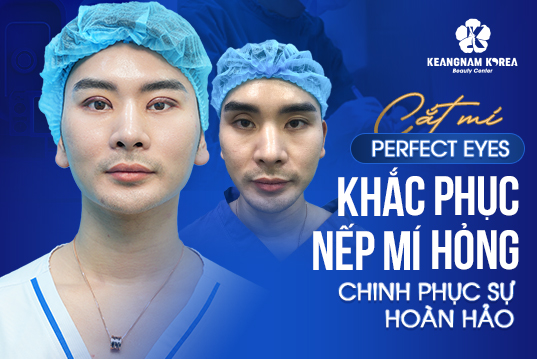 Cấy mỡ mắt