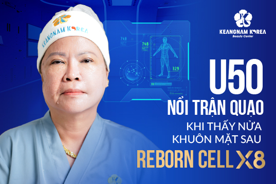 Liệu trình Reborn Cell X8 cho U50