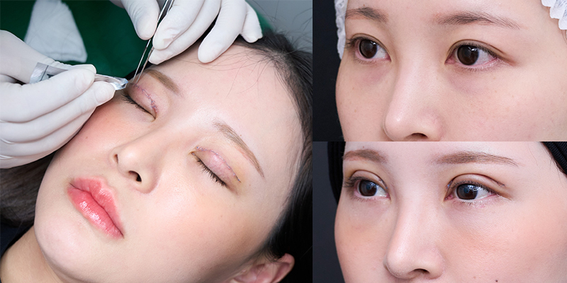 The environment for eyelid surgery at Keangnam Korea