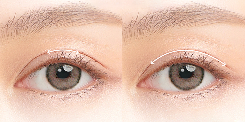 Should I get eyelid surgery or an eyelid lift?