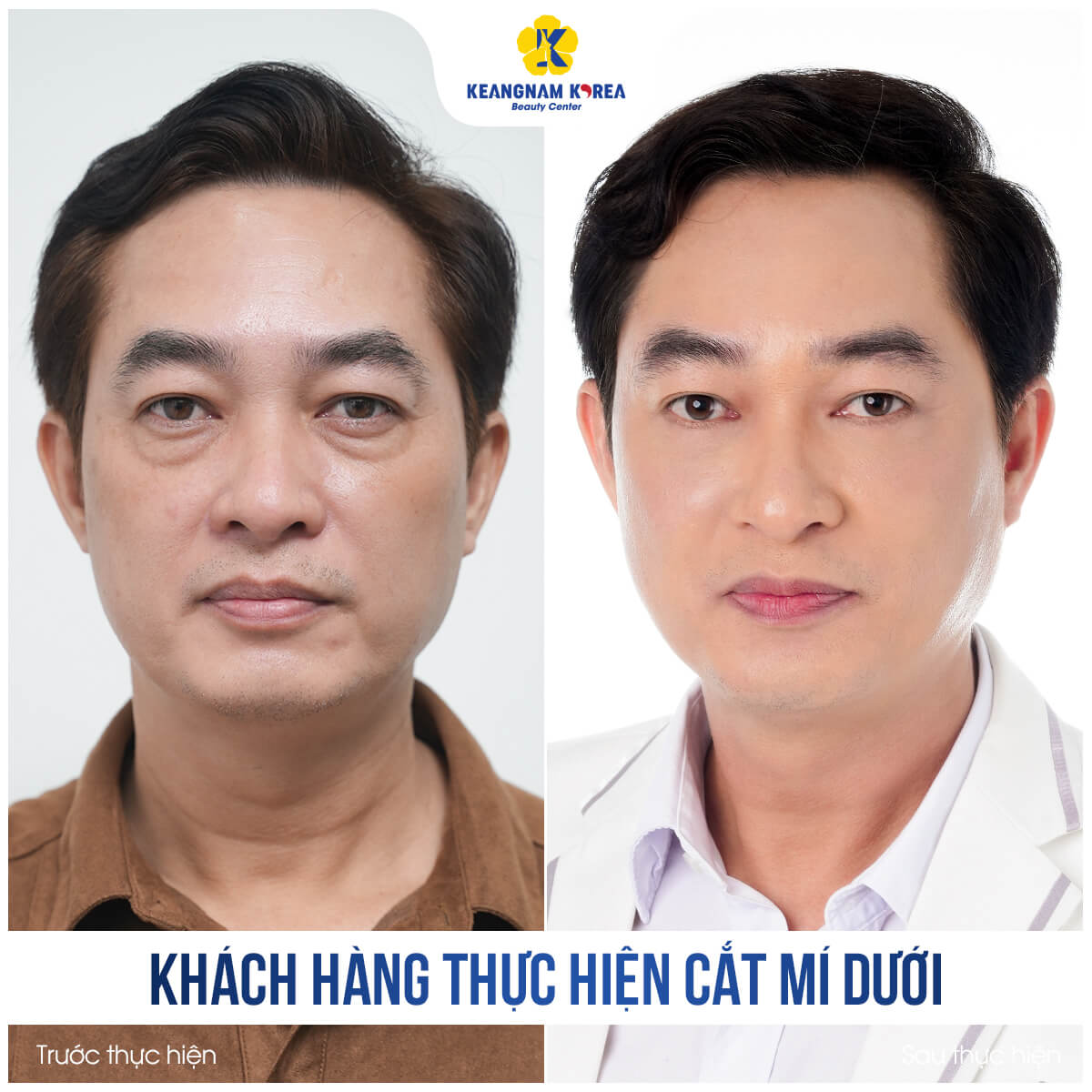 BF_AF_khach-hang-cat-mi-4