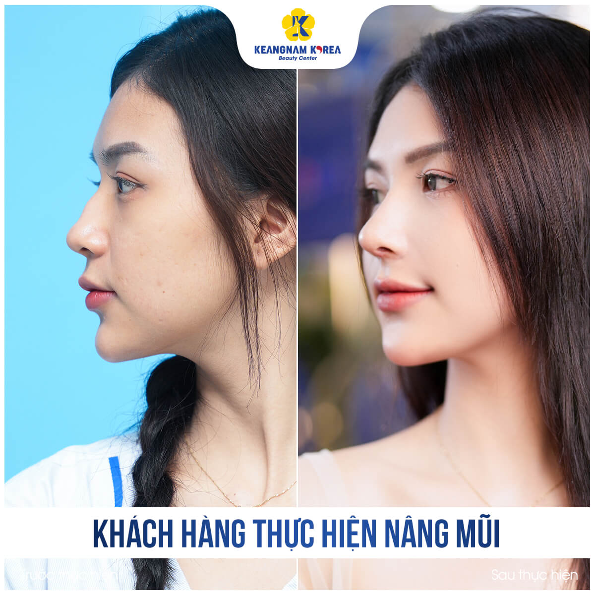 BF_AF_khach-hang-nang-mui-2