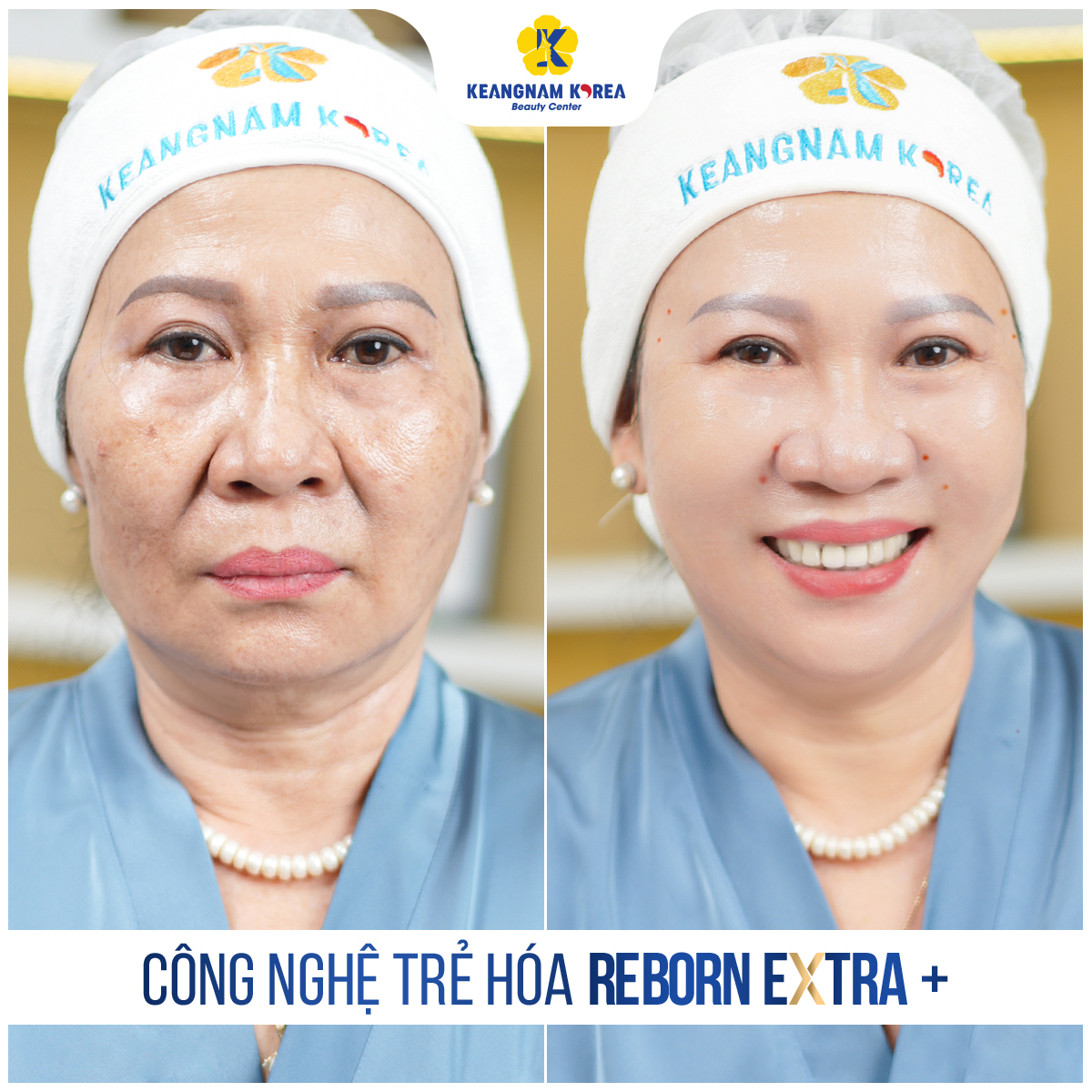 Công nghệ Reborn Cell Extra + 1