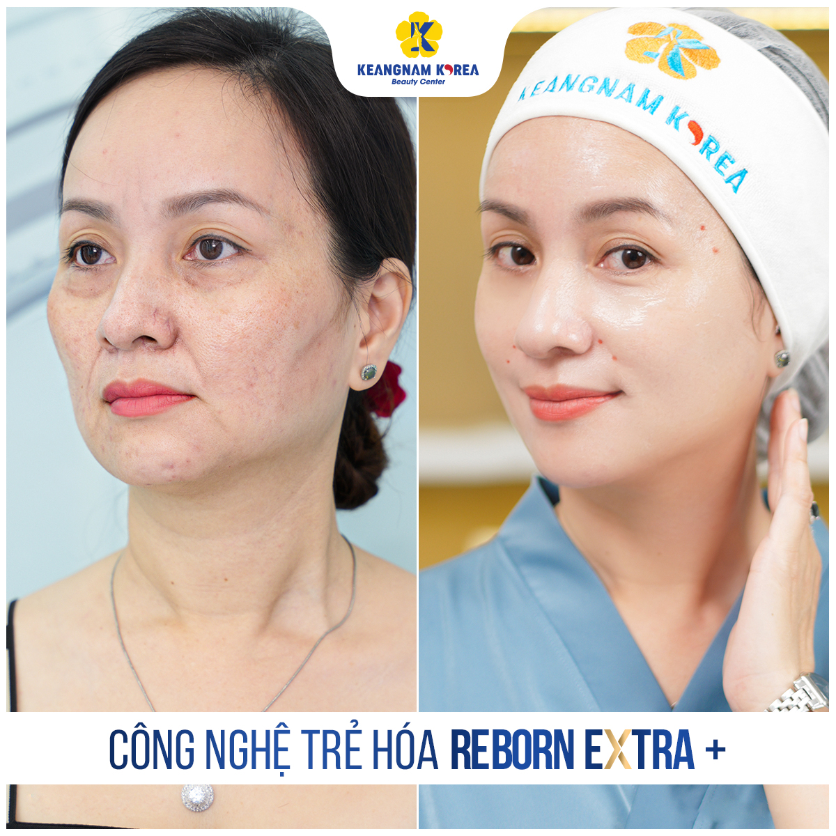 Công nghệ Reborn Cell Extra + 2