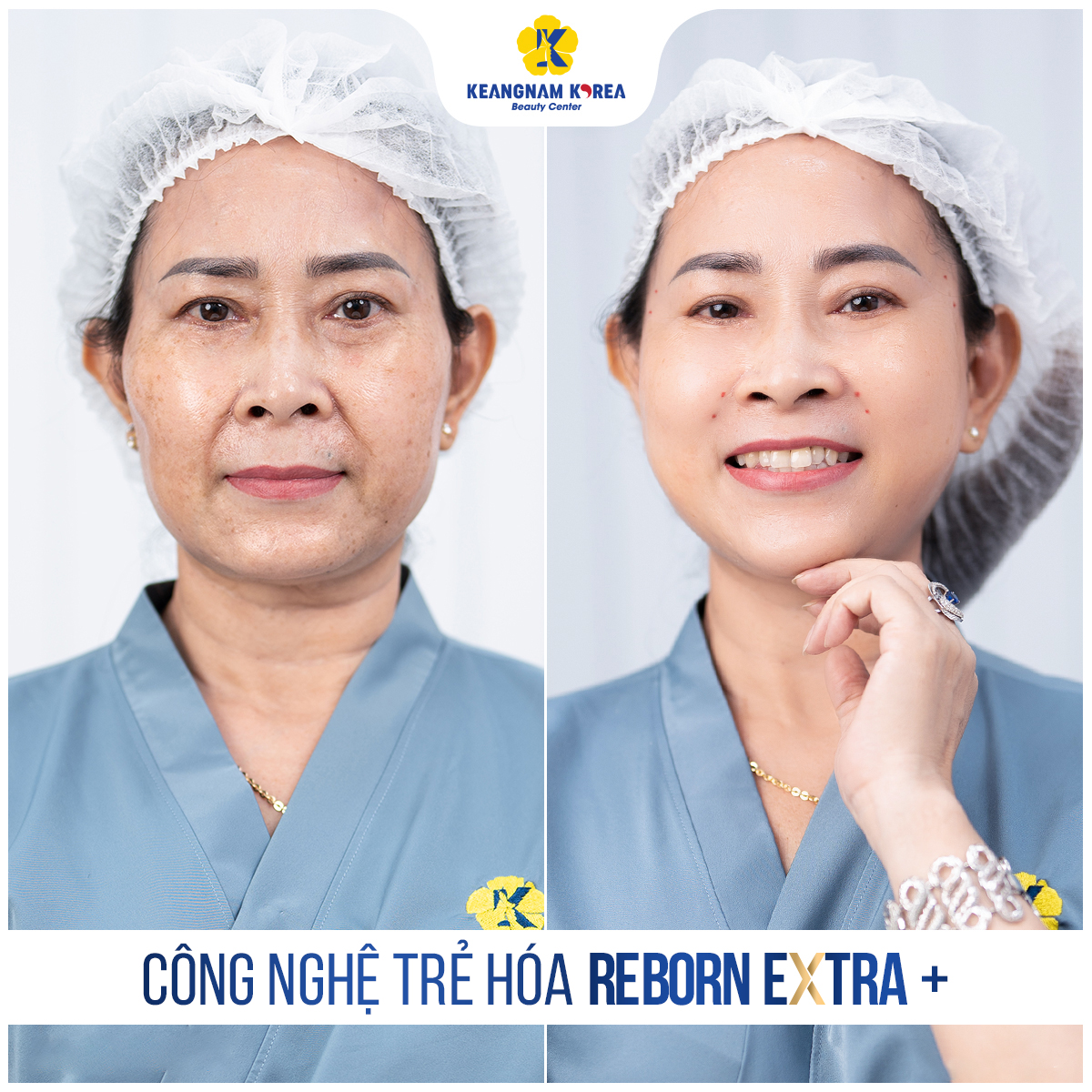 Công nghệ Reborn Cell Extra + 3