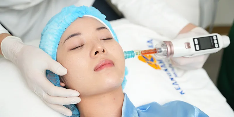 Is Facial Lifting with Meso Exosome Injection Recommended?