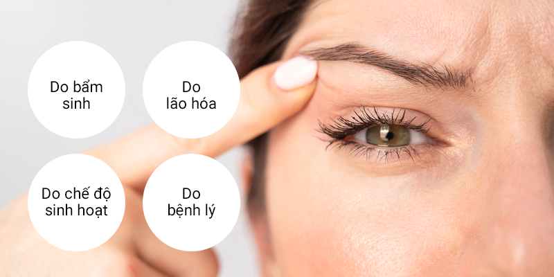 How to Treat Droopy Eyelids at Keangnam Korea