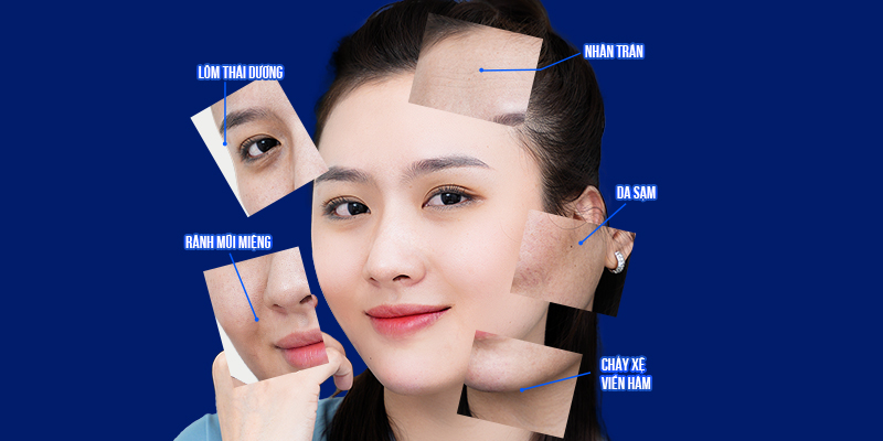 Where is the best place for a forehead lift?