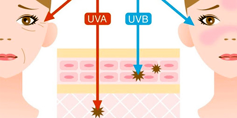 5 Causes of Hori Nevus