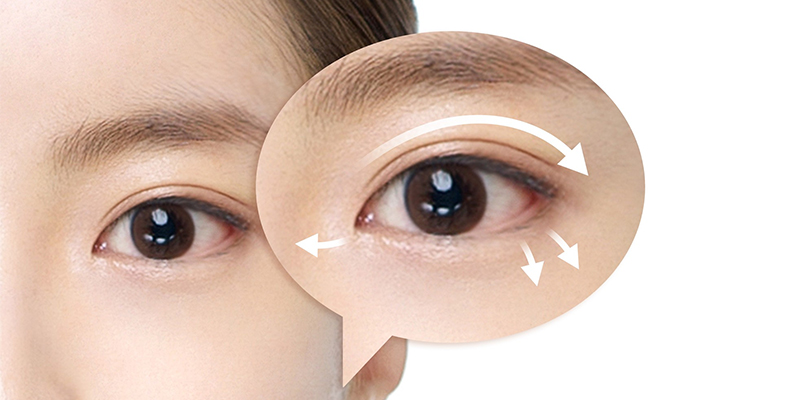 What is Eye Corner Surgery?