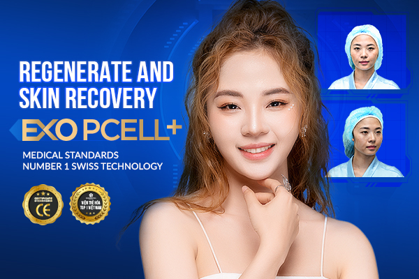 Exo Pcell melasma removal