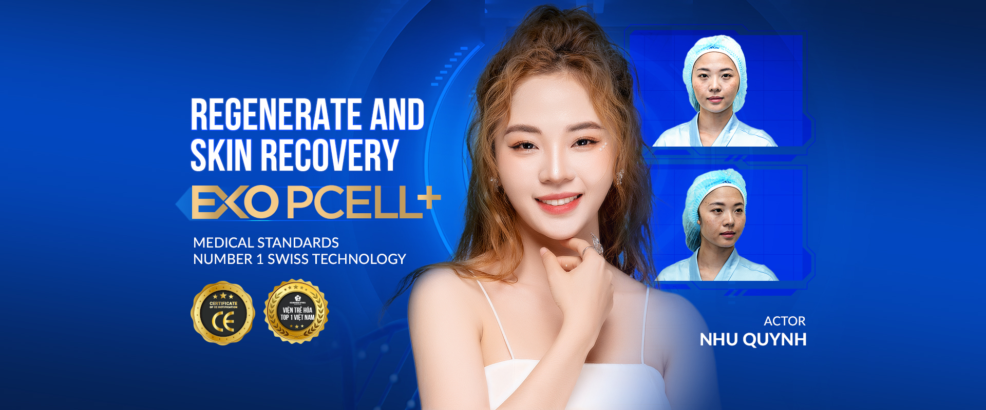 Exo Pcell melasma removal