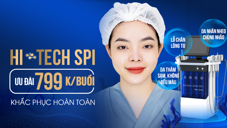 công nghệ hi tech spi