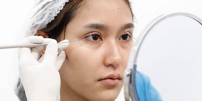 Guidelines for Upper Eyelid Fat Removal