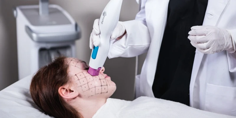 8 Effective Ways to Remove and Treat Crow’s Feet Around the Eyes 4 New Generation Lifting Technology: REBORN CELL EXTRA+