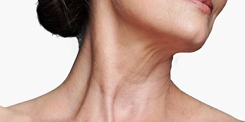 The Latest Neck Skin Tightening Treatment Methods in 2026 1 The Latest Neck Skin Tightening Treatment Methods