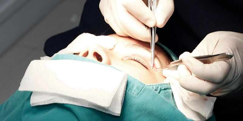 Where Is the Best and Safest Place for Congenital Ptosis Treatment? 3 Congenital Ptosis Treatment Surgery