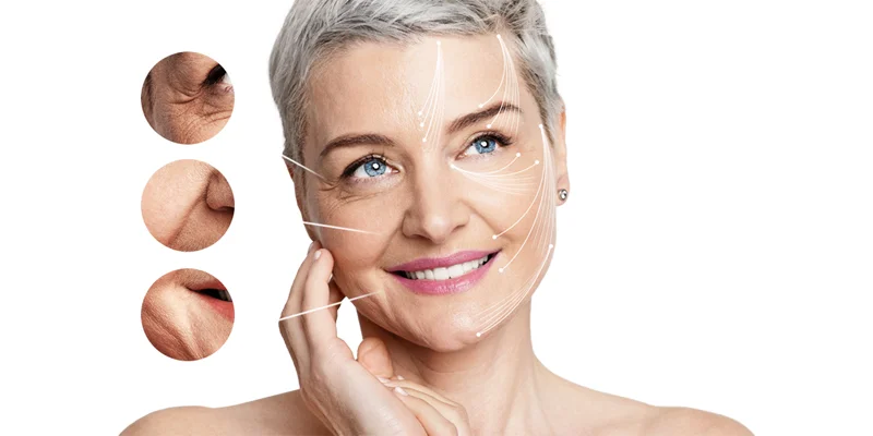 Smile Line Treatment: 7 Ways to Reduce Smile Lines at Home 2 7 Ways to Reduce Smile Lines at Home