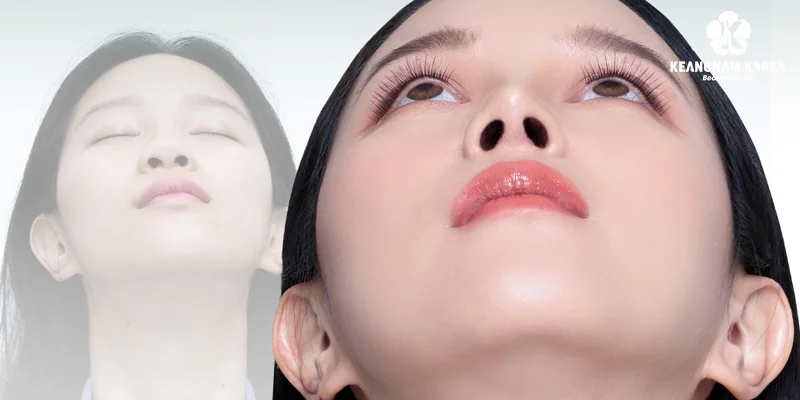 Is Rhinoplasty Worth It? Benefits, Safety & Best Clinic 3 Where Is the Best Place for a Nose Job?