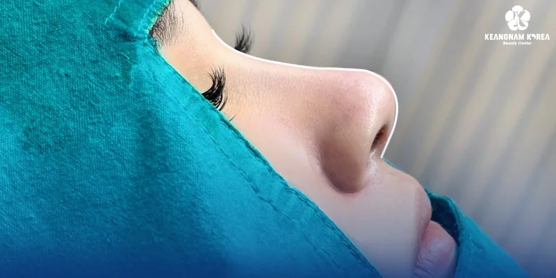 5 Natural Looking Rhinoplasty Services at Keangnam Korea 4 S Line Structural Rhinoplasty