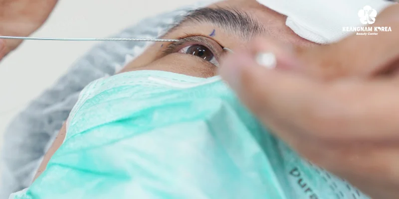 Should You Choose Eyelid Lift or Brow Lift? Which Technique Is More Beautiful and Long-Lasting? 5 Perfect Eyes Eyelid Surgery Technology at Keangnam Korea