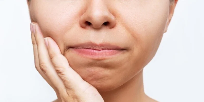 Where Is the Best Place for Smile Lines Treatment Around the Mouth? 2 What Are Smile Lines?