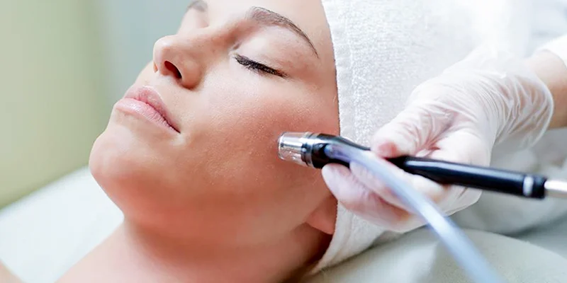 Facelift Methods: 7 Ways to Lift & Tighten Your Skin Fast 4 Facelift with Microdermabrasion