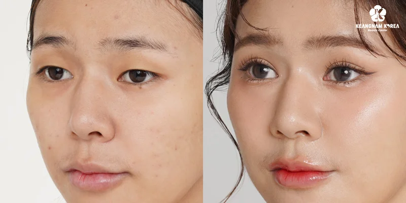 Eyebrow Lift or Eyelid Surgery? Best Choice for Younger Eyes 4 Eye and Brow Condition