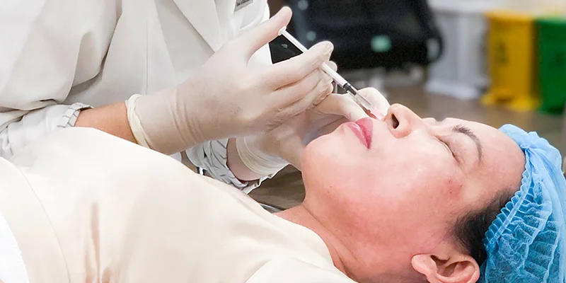 Best Treatment for Melasma: 5 Effective Ways to Remove Facial Pigmentation 4 Mesotherapy for Facial Melasma Treatment