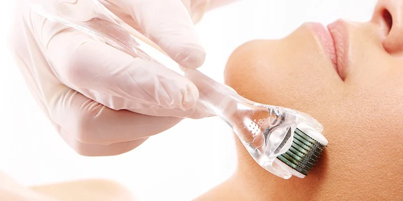 Is Microneedling for Melasma Recommended? What Are the Pros and Cons? 1 Microneedling for Melasma: Benefits, Risks & Treatment Results