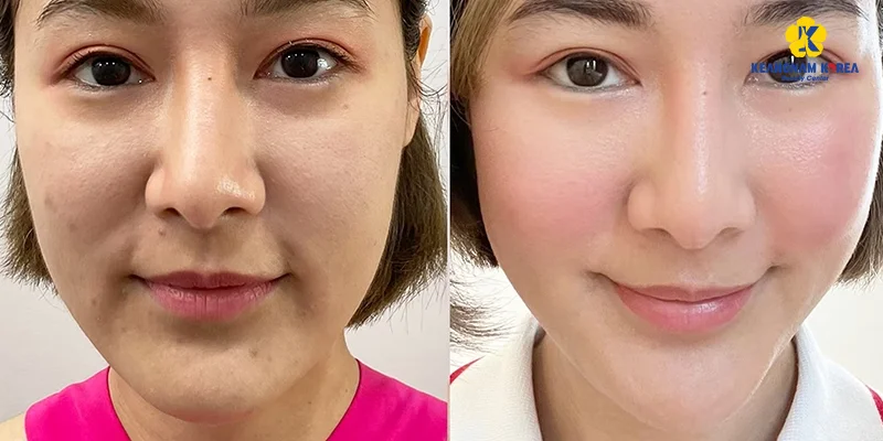Best Place for Dark Spot Treatment: Spa vs Dermatology Hospital vs Aesthetic Clinic 6 Which Place Is Best for Dark Spot Treatment