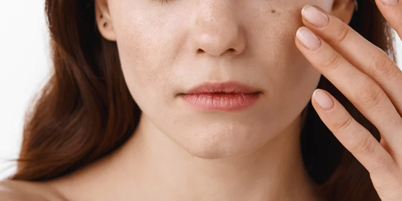 Best Place for Dark Spot Treatment: Spa vs Dermatology Hospital vs Aesthetic Clinic 1 Is It Better to Get Dark Spot Treatment at a Spa, Dermatology Hospital, or Aesthetic Clinic?