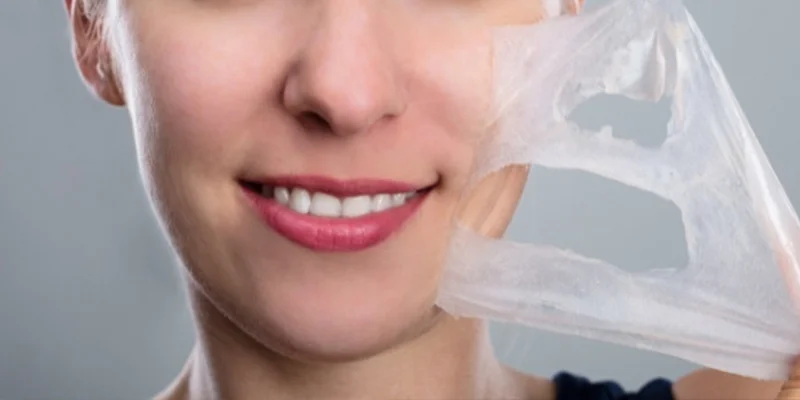 Melasma on Cheeks: 8 Effective Treatments from Mild to Severe 4 How to Treat Moderate Melasma on Both Cheeks