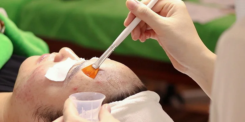 Epidermal Melasma: 6 Common Causes and 5 Effective Treatments 4 cach dieu tri nam mang go ma