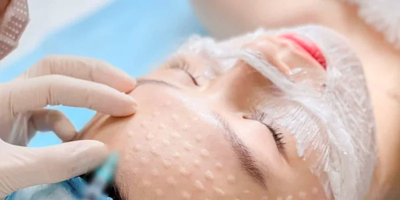 Is Meso for Melasma Effective? Benefits, Risks & Results 1 Meso for melasma is considered one of the most effective treatments available today for reducing pigmentation and reversing skin aging.