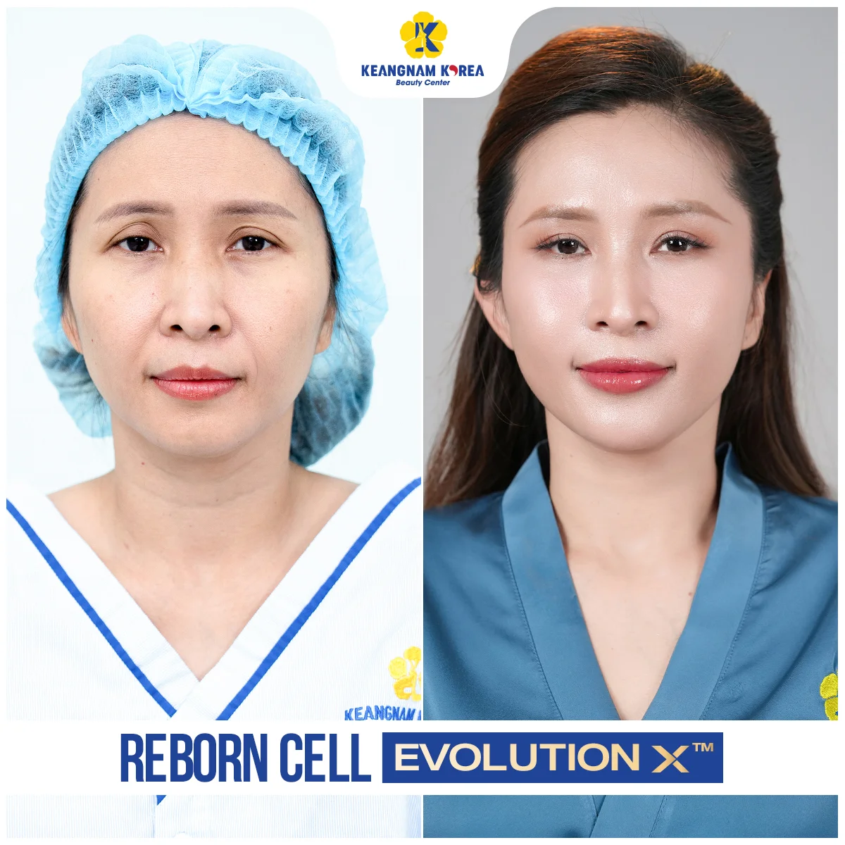 Trang chủ 14 1200x1200_RBE_Web2026_Ngoc-Lien (1)