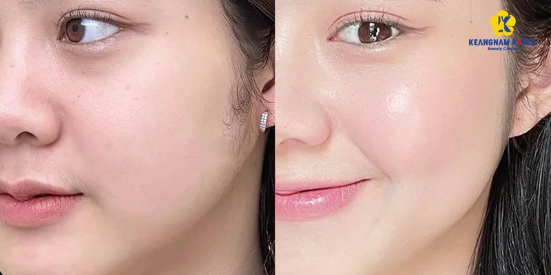 Hydrated Skin: 3 Ways to Restore Dry Skin Naturally 5 Professional Hydrated Skin Solution in Just One Hour