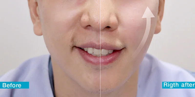 How to Get Glowing Skin for Men: 4 Expert-Recommended Methods 1 4 Effective Ways to Get Glowing Skin for Men
