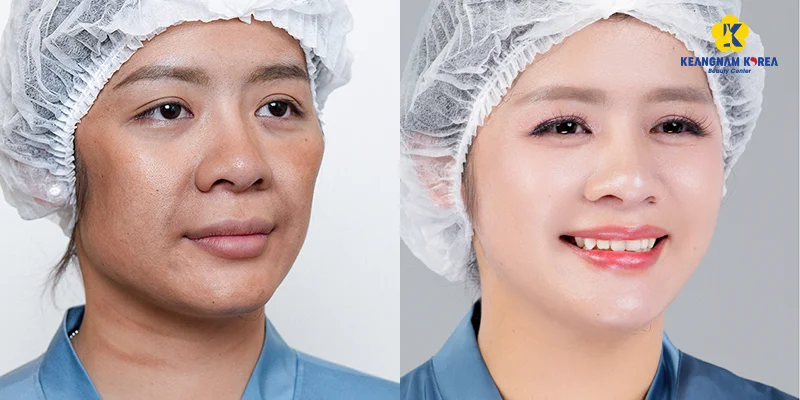 How to Get Glowing Skin: 6 Effective Ways for Naturally Radiant Skin 5 Keangnam Korea proudly incorporates Reborn Cell technology