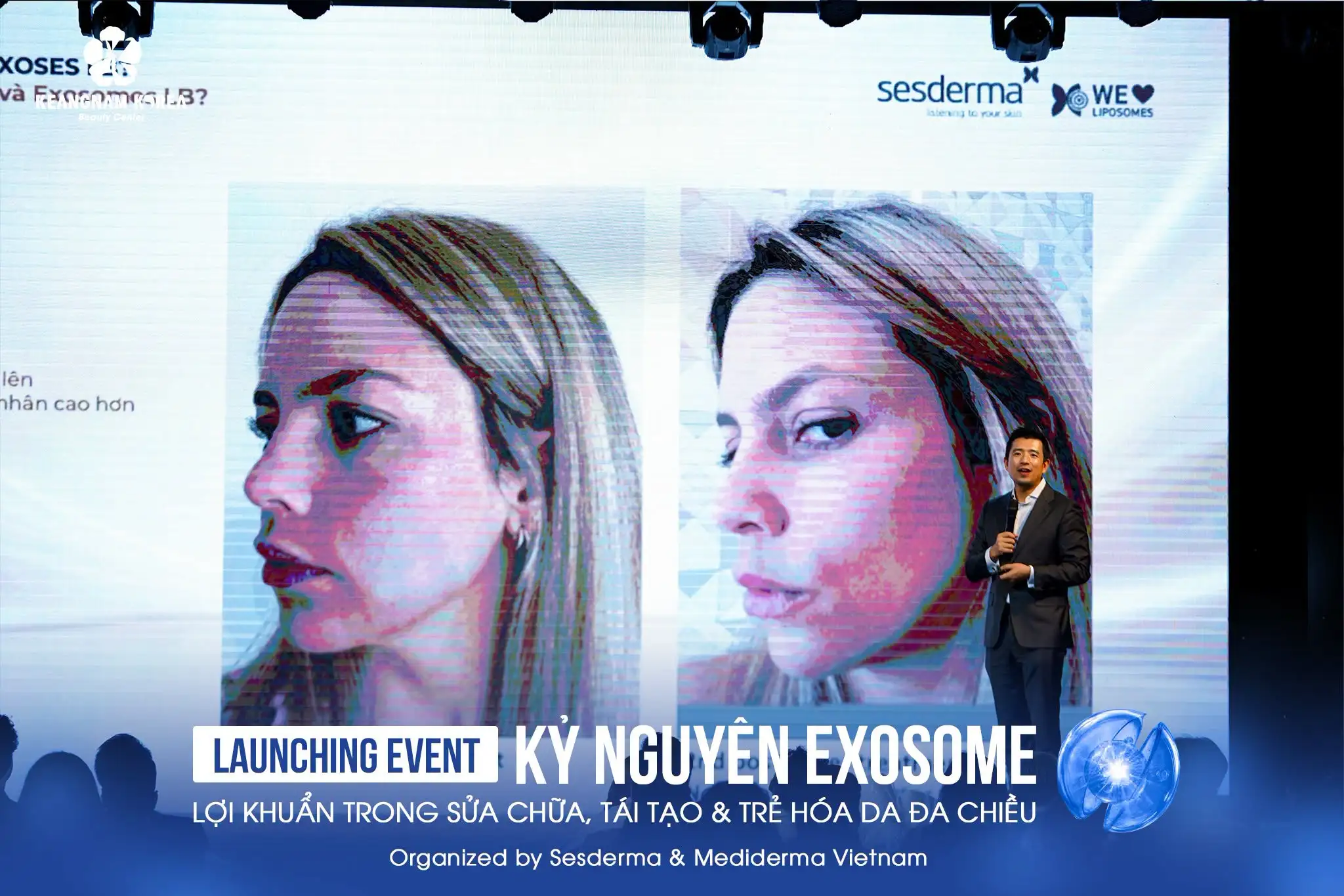 The Rise of Probiotic Exosomes: Keangnam Korea Explores Emerging Trends in Regenerative Dermatology 3 Exploring Scientific Perspectives on Probiotic Exosomes