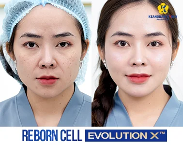 Home 18 BF-AF-REBORN-CELL-EVOLUTION-X™-2