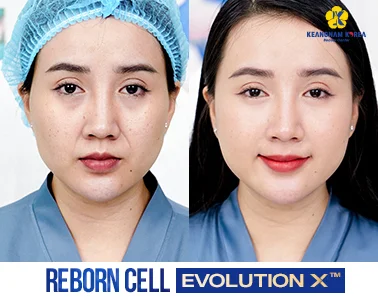 Home 20 BF-AF-REBORN-CELL-EVOLUTION-X™-3