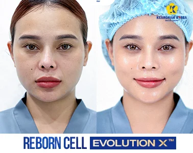 Home 21 BF-AF-REBORN-CELL-EVOLUTION-X™-4
