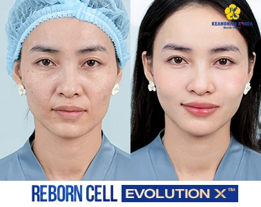 Home 17 BF-AF-REBORN-CELL-EVOLUTION-X™_1