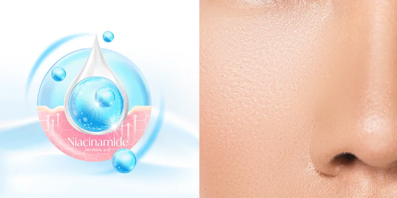 How to Treat Melasma on Cheeks at Home: 4 Effective Ways to Fade Dark Spots 4 Important Tips for How to Treat Melasma on Cheeks at Home