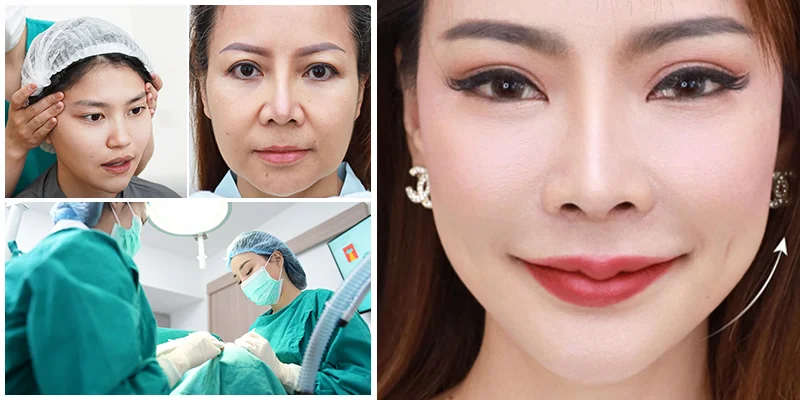 Where Is the Best Place for a Glowing Skin Treatment ? 4 Endoscopic Facelift – One of Korea's Most Popular Glowing Skin Treatments
