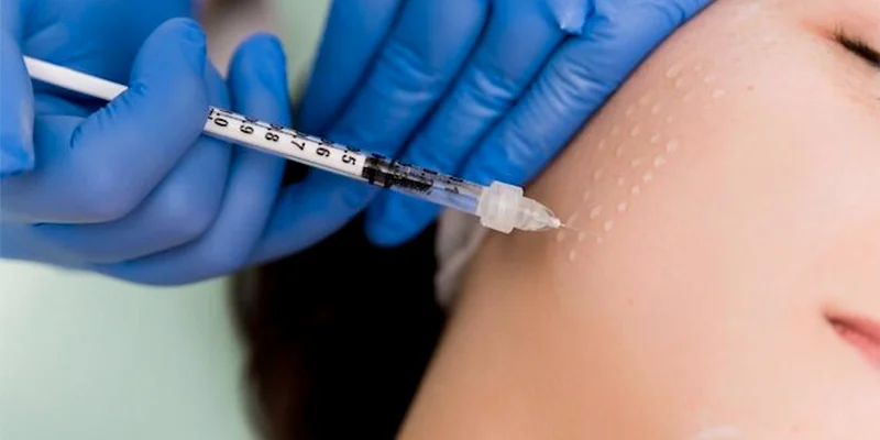 What Is Mesotherapy? Who Should (and Shouldn't) Get It 1 What is mesotherapy — micro-injection technique explained