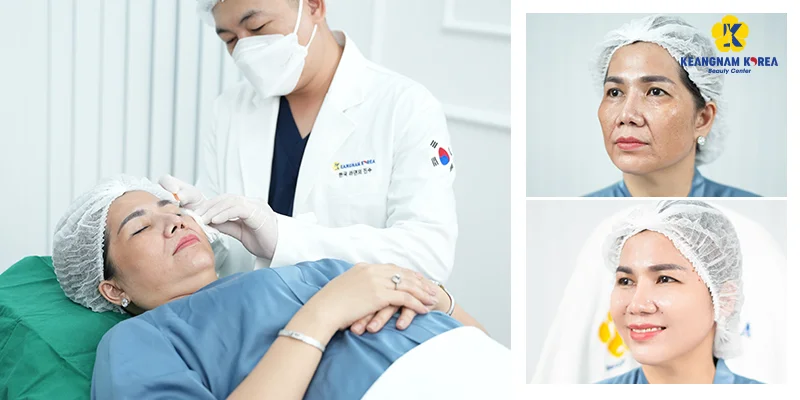 Mesotherapy or Endoscopic Facelift: Which Skin Fix? 4 Exosome-based mesotherapy technology for skin renewal